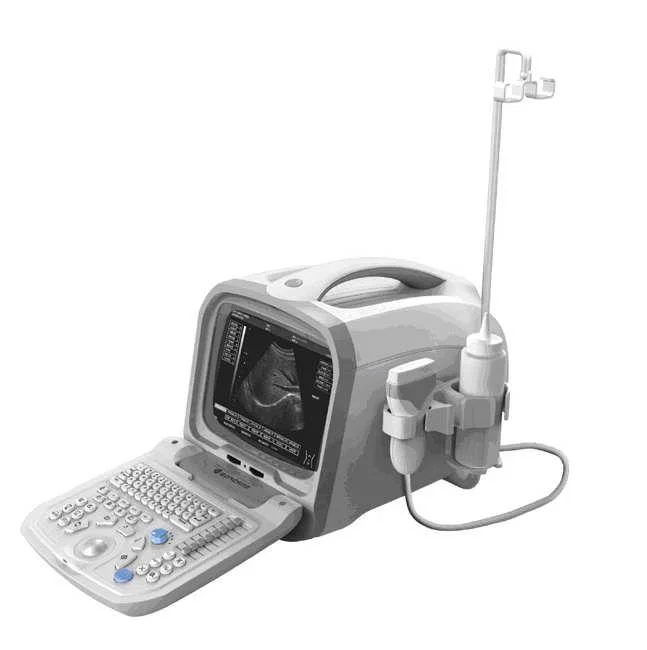 Ultrasound System; PT3000d1; Portable Digital Ultrasonic Diagnostic System; Laptop Full Digital Ultrasound Scanner