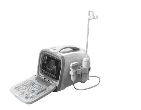PT6601 Portable Ultrasound System, Digital Ultrasonic Diagnostic System with High Quality for Medical Equipment, Hospital Equipment