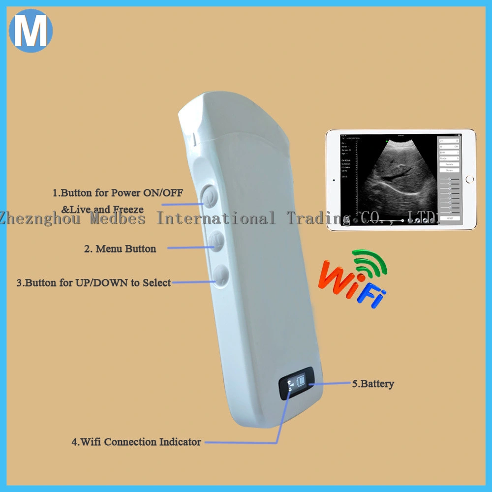 128 Elements Wireless Probe Ultrasound Scanner with Linear Probe or Convex Probe
