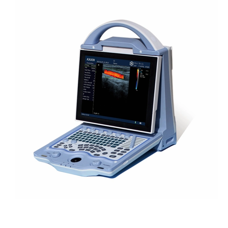 Portable Ultrasound Machine Color Doppler 2D Ultrasound Scanner Price Liver, Gallbladder, Spleen Image Ultrasound Machine
