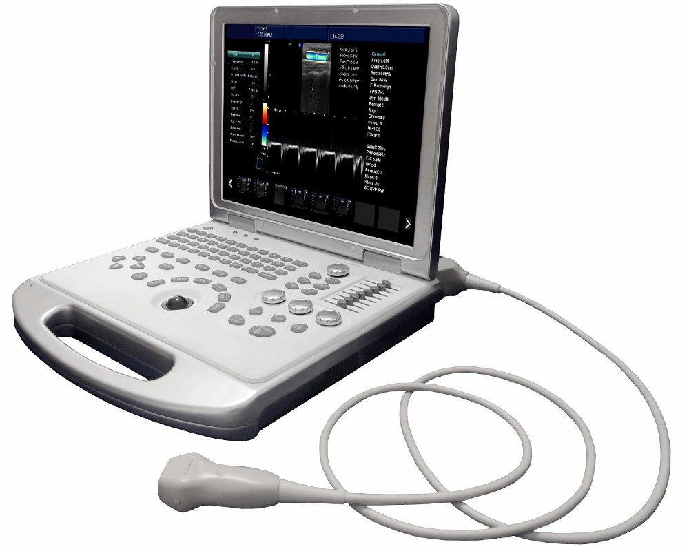 Medical Equipment 3D 4D Color Doppler Ultrasonic Equipment Ultrasound Machine