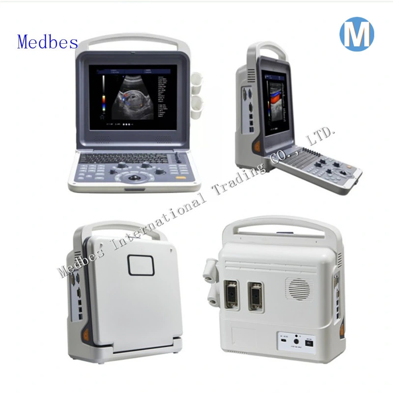 Ultrasound Machine Portable/Ultrasound Machine Color Doppler Ultrasound
