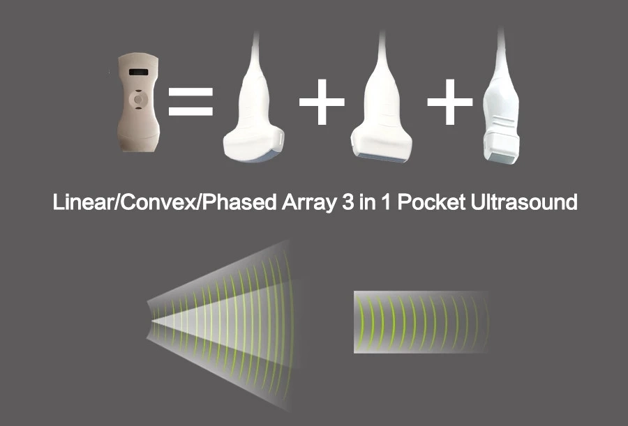 Linear/ Convex Probe Color Doppler Ultrasound Portable Wireless Probe Ultrasound Scanner