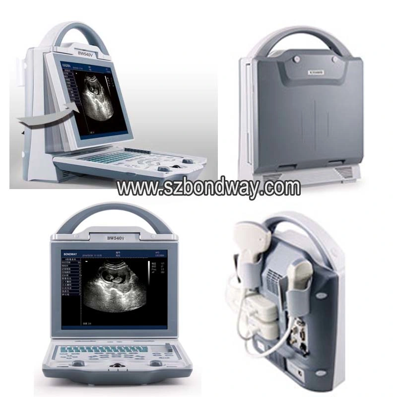 Veterinary Ultrasound Scanner Portable Ultrasound Medical Equipment, Portable Doppler Ultrasonic System, Mobile Medical Ultrasonic Machine