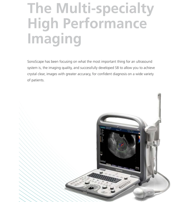 Sonoscape S8 Portable 4D Color Doppler Ultrasound Portable Laptop Ultrasound Machine Sonoscape Ultrasound Price