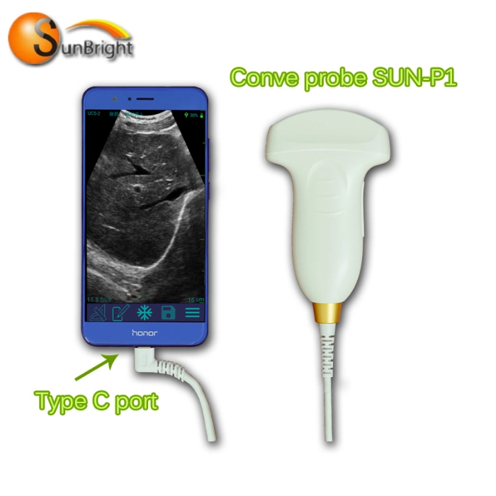 Portable USB Probe Mini Ultrasound Device Medical Hand Held Ultrasound Convex Probe