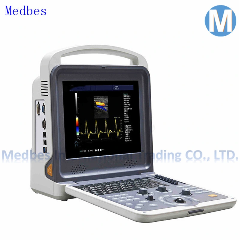 4D Portable Color Doppler Ultrasound System Color Doppler Ultrasound Equipments Sonoscape S6 Portable Color Ultrasound Doppler