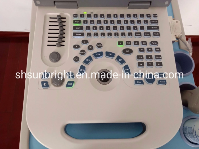Ultrasound B Ultrasound Human Convex Probe Laptop Ultrasound Scanner