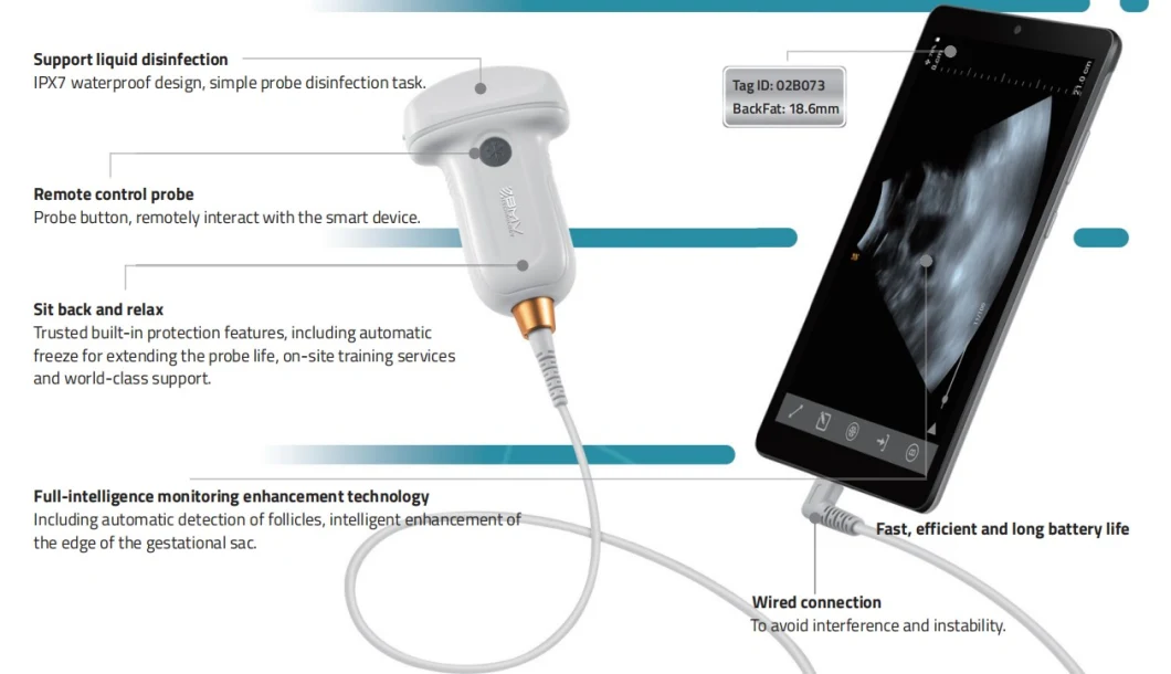 2018 USB Convex Ultrasound Scanner Mini USB Convex Probe /Portable Ultrasound Scanner for Ultrasound