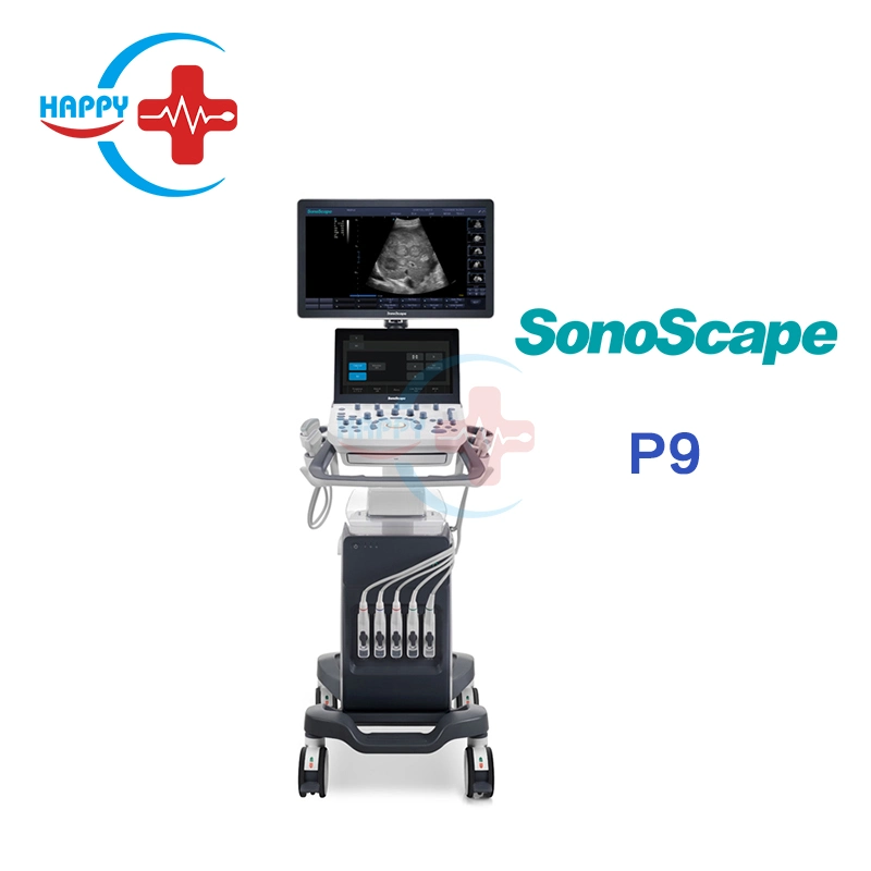 Clinic Use Sonoscape Ultrasound Price /Ultrasound Machine P9 /Sonoscape Ultrasound
