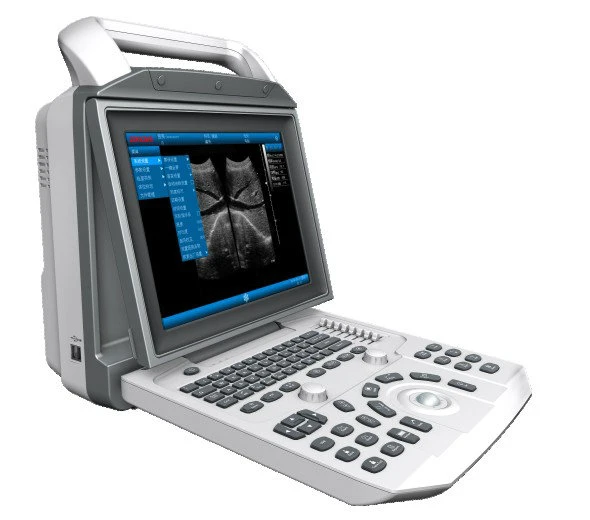 Ultrasound System; PT3000d1; Portable Digital Ultrasonic Diagnostic System; Laptop Full Digital Ultrasound Scanner