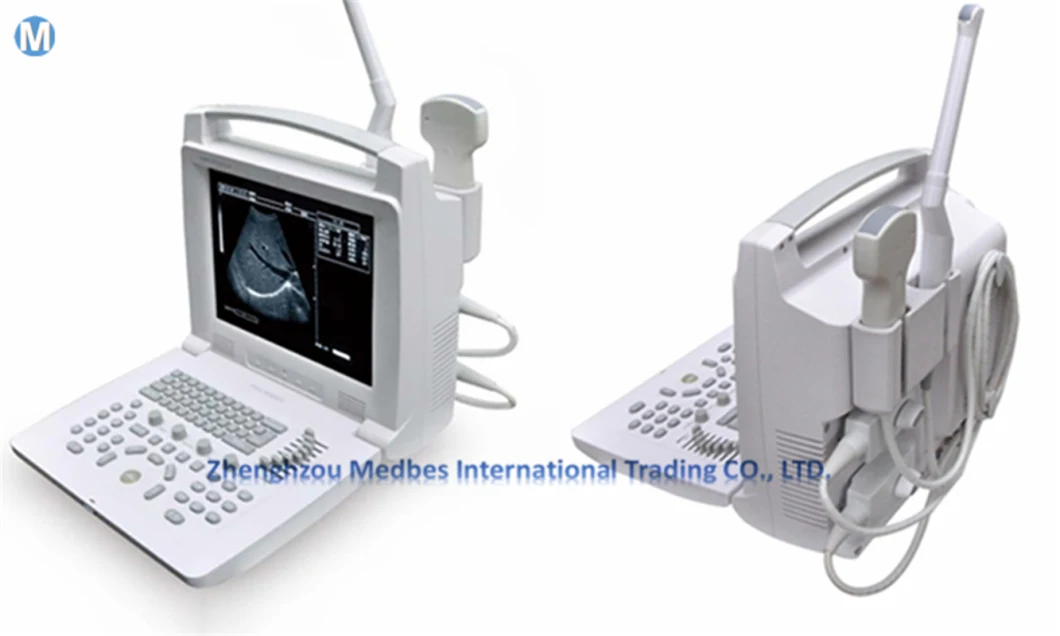 Portable Multi Language Options Best B/W Ultrasound Machine Price