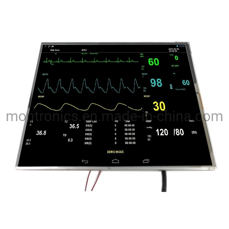 Open Frame 17 Inch TFT LCD Touch Screen Display Touch Screen Medical Ventilator Touch Screen Display