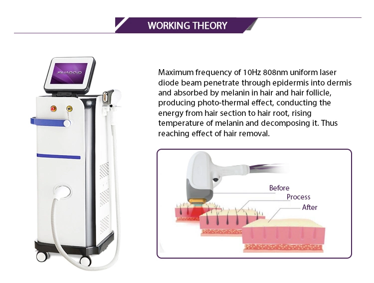 808nm Permanent Hair Removal Machine/All Akin Types Hair Removal/All Hair Types Hair Removal