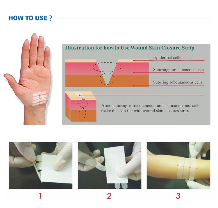 Factory Direct Supply Disposable Sterile Adhesive Surgical Wound Closure Strips