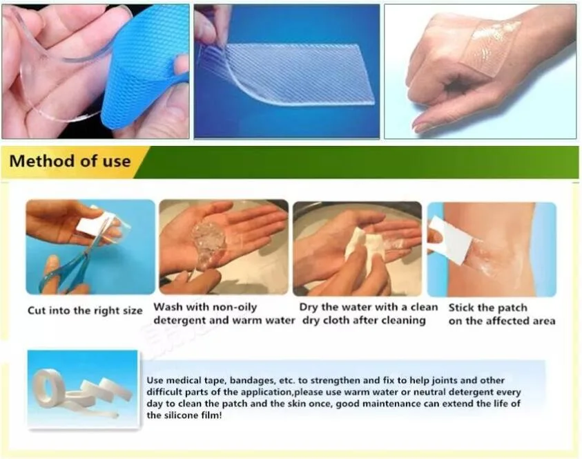 Silicone Strips for Scars, Silicone, Repair Damaged Skin