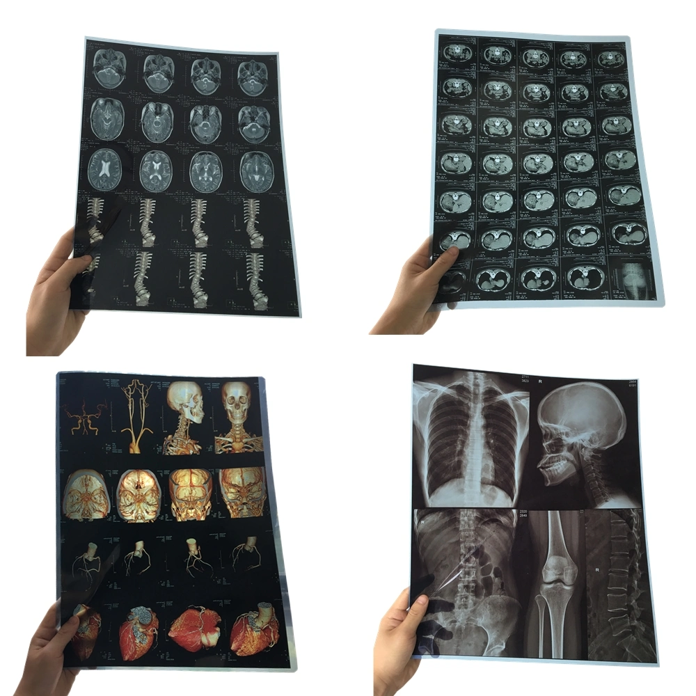 Low Price Medical X-ray Printing Film / Inkjet Film / Printable Image