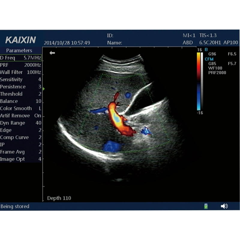 Vascular Doppler Ultrasound Blood Flow Detector B Mode Measurement Doppler Ultrasound Machine