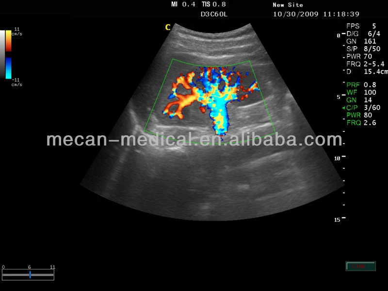 Mc-Du-Q6 Compact & Reliable Portable Cardiac Vascular Doppler Ultrasound Blood Flow