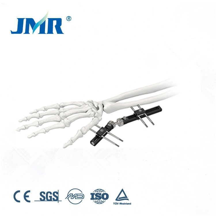 Wrist External Fixator Tibial Distal Bone Fracture External Fixation Device