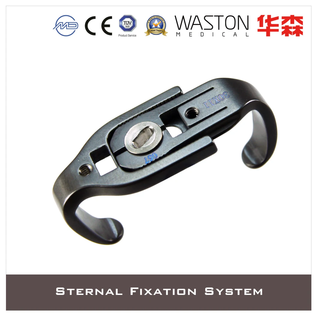 Locking Implant Trauma Sternal Fixation Throacic Closure Loc Plate
