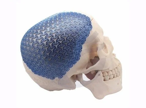 Maxillofacial Implants Manufacturer Titanium Mesh Cranial Mesh