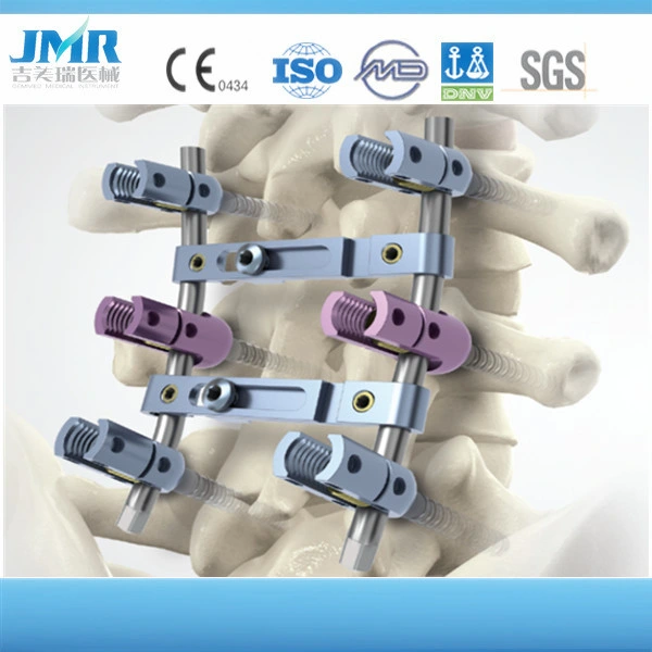 Ce, ISO Certificated Manufacture, Trauma Plate Screw, Orthopedic Implants, Trauma Bone Plate