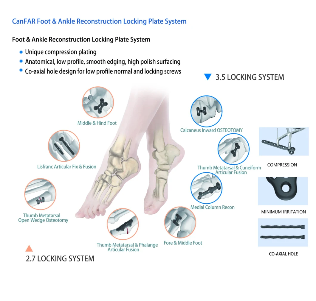 Foot and Ankle Reconstruction Titanium Locking Bone Plate, Orthopedic Implant