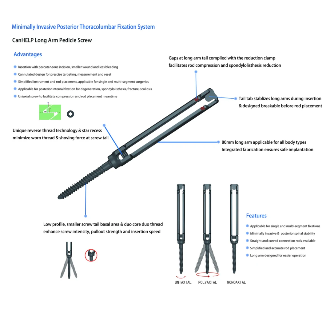 Minimally Invasive Titanium Spine Pedicle Screw, Medical Implant and Instrument