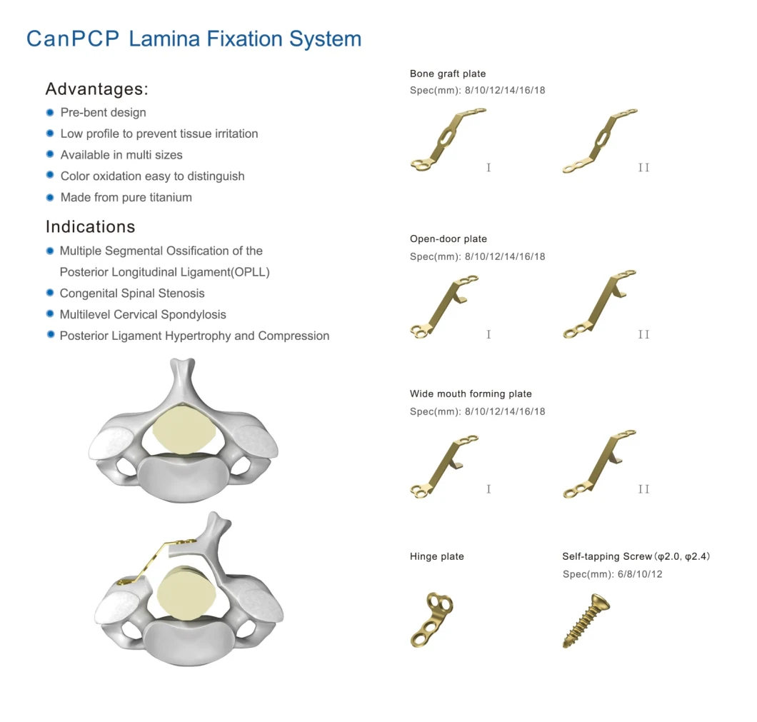 Canwell Laminoplasty Fixation System Hinge Plates Orthopedic Spinal Implant, Hinge Plates