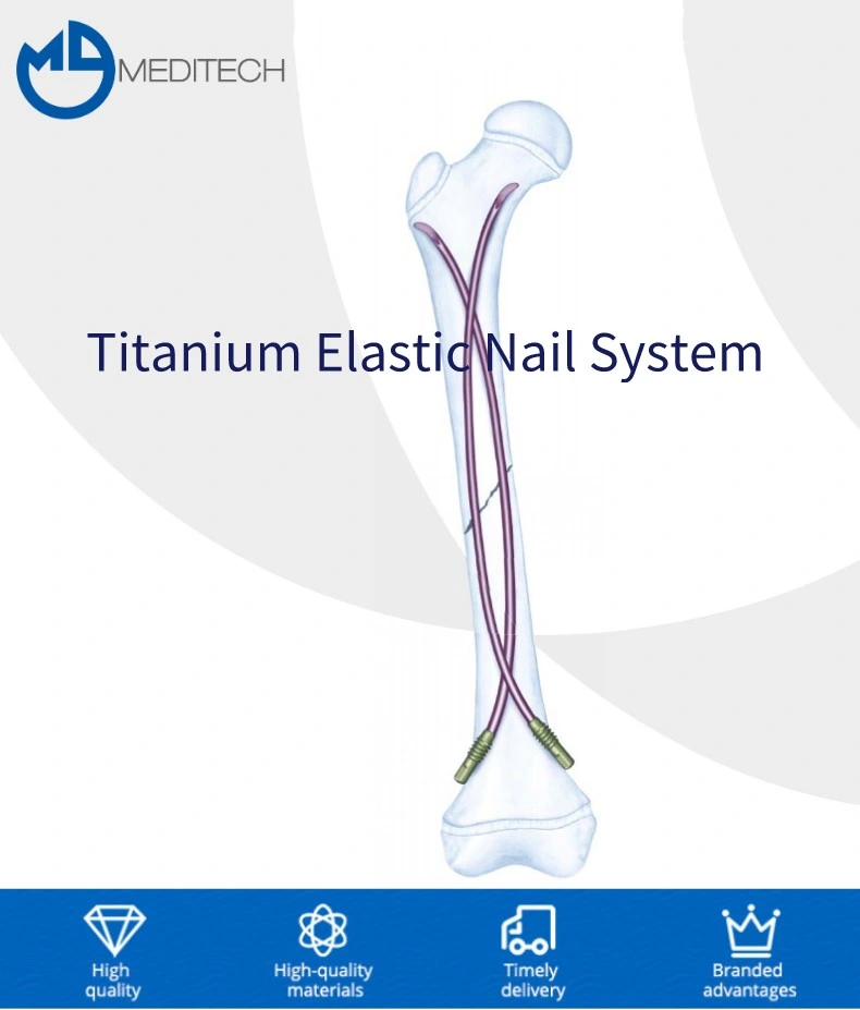 Quality Guaranteed Titanium Elastic Nail Orthopedic Surgical Implants Interlocking Nail Intramedually Nail