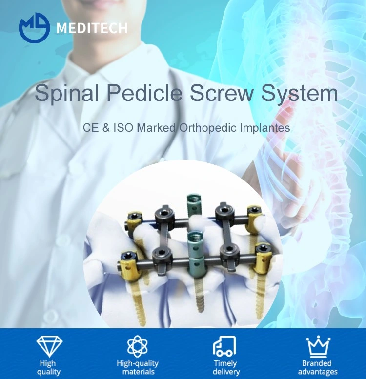 Best Price Orthopedic Implant Monoaxial Pedicle Screw Spinal Surgery Titanium Screw