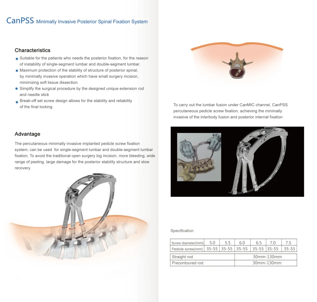 Canwell Pecutaneous Pedicle Screw, Posterior Spine Lumbar Orthopedic Implant Titanium