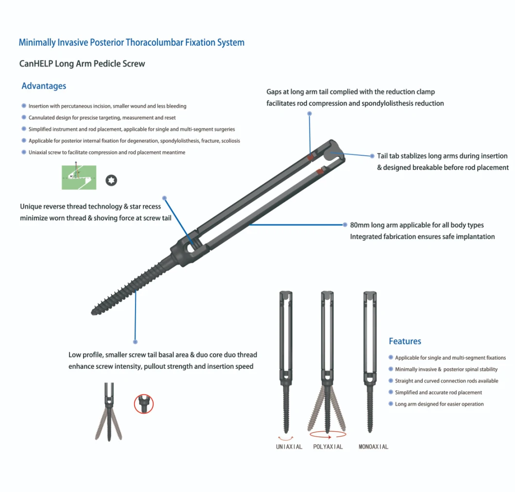 Canwell Medical Minimally Invasive Titanium Spine Pedicle Screw, Medical Implant and Instrument