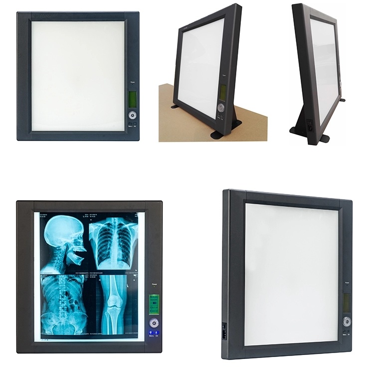 Adjustable Medical LED X Ray Imaging Film Viewer View Box X Ray Film Viewer