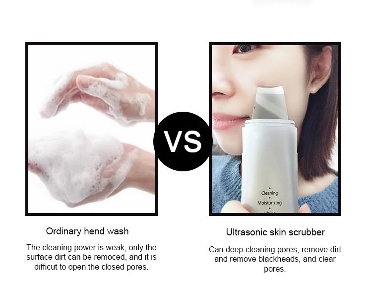 Skin Scrubber Facial Lift Treatment Face Beauty Spatula Ultrasonic Skin Scrubber